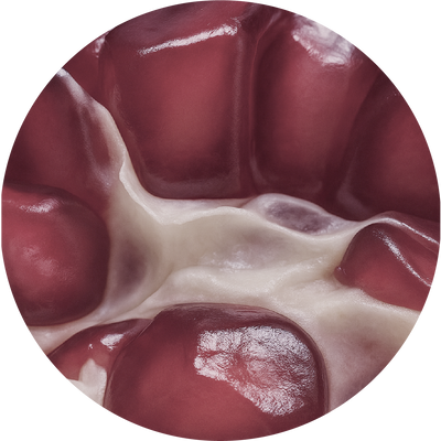 Pomegranate Callus Cultures